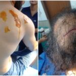 श्रीनगर-पौड़ी मोटरमार्ग पर गुलदार ने युवक पर किया हमला, बुरी तरह जख्मी