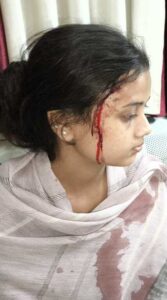 Nainital : लालकुआं में युवती के सिर में ईट मारी,सीसीटीवी फुटेज वायरल